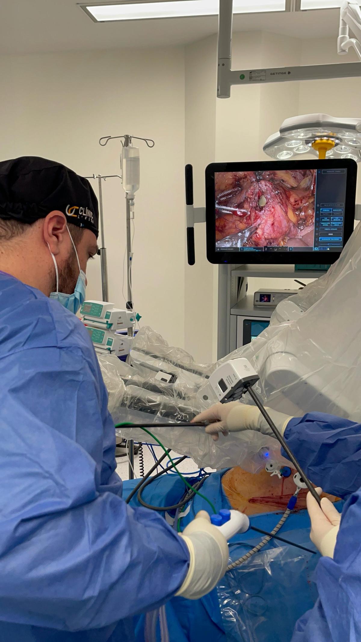 Clínic Lleida realitza la primera reconstrucció de bufeta amb cirurgia robòtica a Lleida