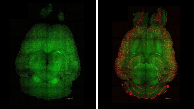 Imágenes de microscopía de fluorescencia basada en hoja de luz del cerebro de un ratón 12 horas después de haber sido tratado (izquierda) o no (derecha) con nanopartículas. Se analizaron los cerebros para ver
