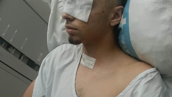 La víctima, de 18 anys, a l'Hospital