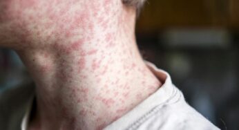 Alerta sanitària a Catalunya: Detectats el doble de casos en la meitat de temps